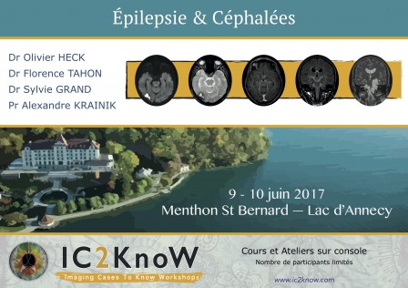 IC2KnoW_Epilepsie-Cephalees_poster.jpg, fév. 2017 IC2KnoW_Epilepsie-Cephalees_poster.jpg