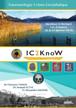 Affiche_IC2KnoW_jan2018_Trauma.jpg, nov. 2017 Affiche_IC2KnoW_jan2018_Trauma.jpg